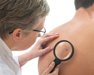 Skin cancer surveillance and surgery